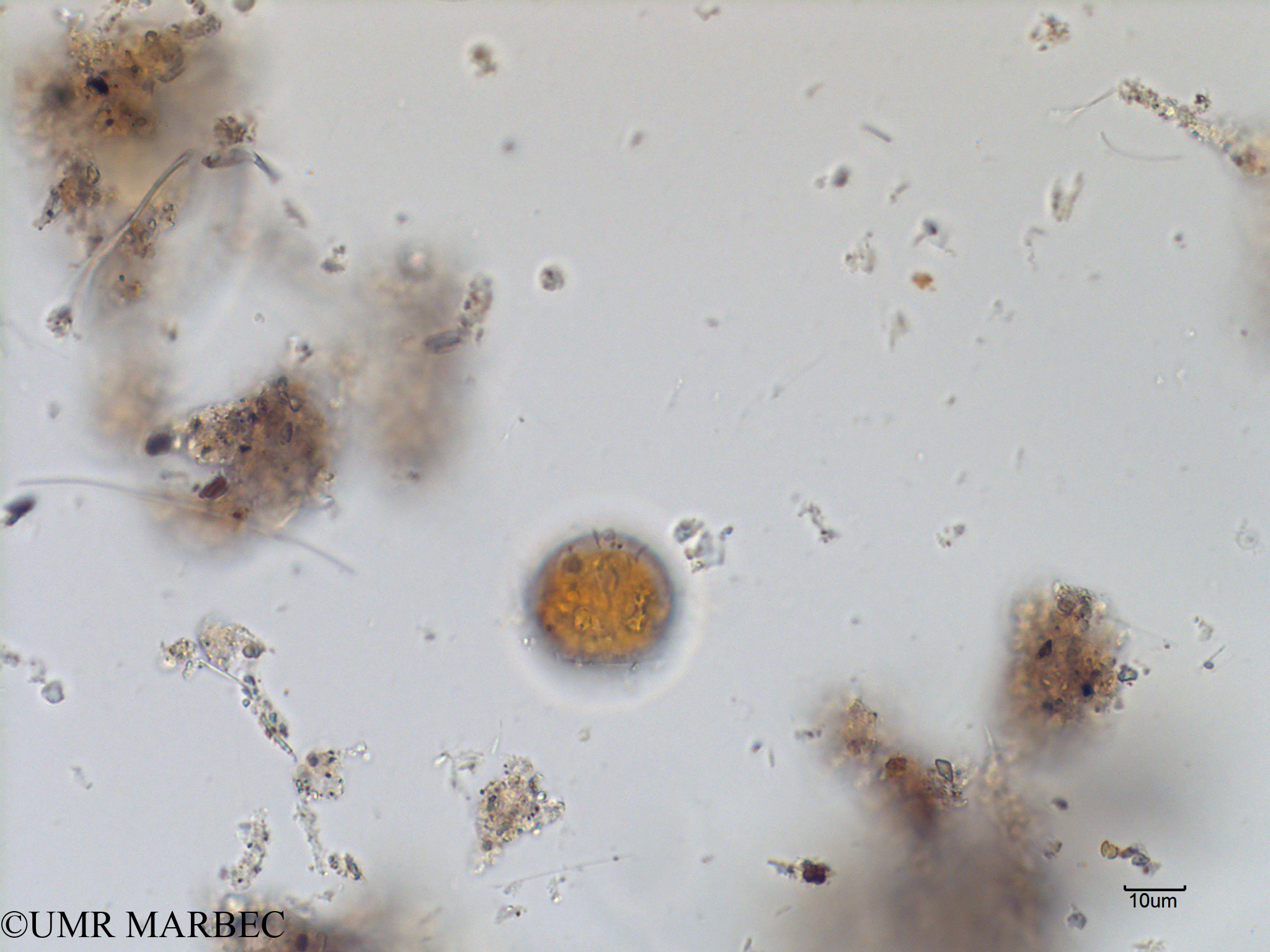 phyto/Scattered_Islands/mayotte_lagoon/SIREME May 2016/Protoperidinium sp42 (MAY4_proto lequel c-3).tif(copy).jpg